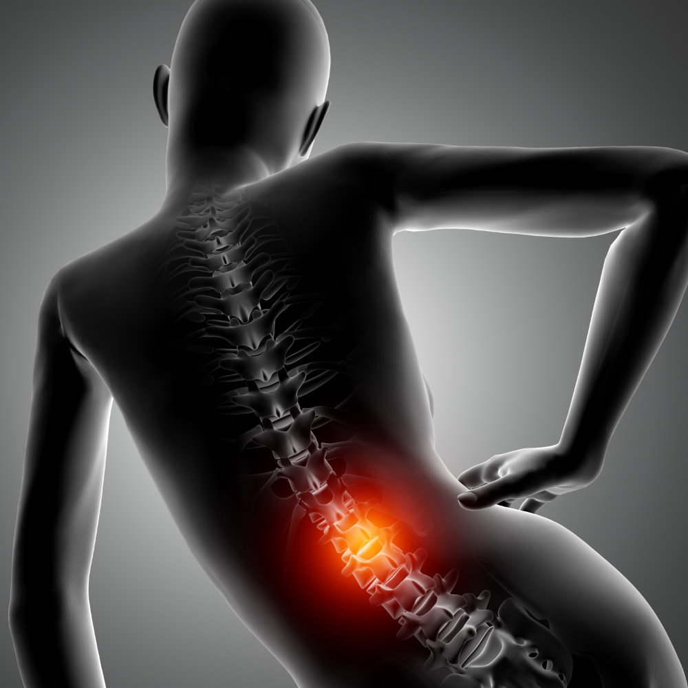 Strength training for lower back pain: what the best evidence actually says image 1